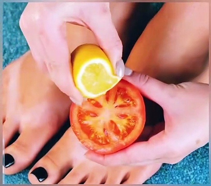 How to remove it
