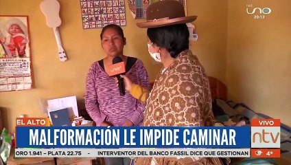 Jair que tiene un amalformación que le impide caminar.