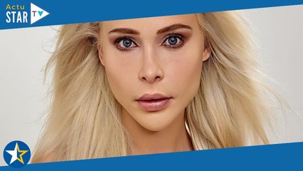 Un mannequin dépense 146 000 euros pour se faire rallonger les jambes, le résultat impressionnant en