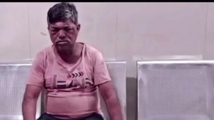 कटनी: मधु मक्खियों के झुंड ने वृद्ध को किया घायल,उपचार जारी