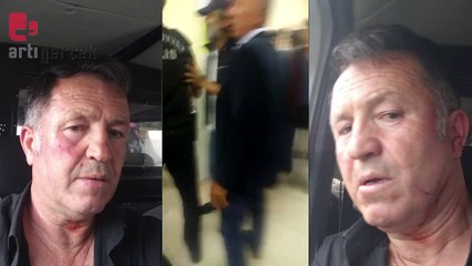 Malatya'nın Battalgazi ilçesinde AKP'liler, Yeşil Sol Parti müşahitlerine saldırdı ve darp etti