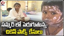 Chicken Pox Cases Increasing In Summer ,Public Hospitalized With Chicken Pox | V6 News