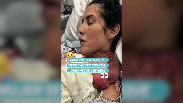 Médico llora en parto de paciente al descubrir en plena cesárea que mujer tenía cáncer terminal