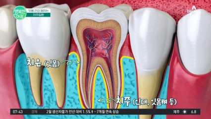 [닥터하우스] ※잇몸에서 피가 난다면 시청 필수※ 잇몸 건강은 방치하지 말고 미리 관리하자! #치주질환