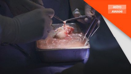 Pembedahan pindah buah pinggang babi ke manusia pertama di AS