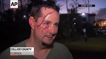 Bear Attacks Florida Man As He Lets Dog Outside
