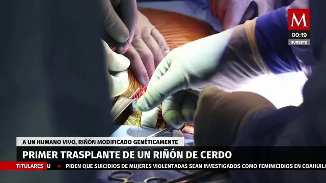 Trasplantan riñón de cerdo a paciente vivo por primera vez en EU