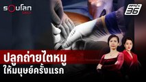 สหรัฐฯ ปลูกถ่ายไตหมูดัดแปลงพันธุกรรมให้มนุษย์ครั้งแรก | รอบโลก Daily | 22 มี.ค.67