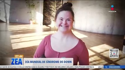 Síndrome de Down: Expectativa de vida y oportunidades de desarrollo