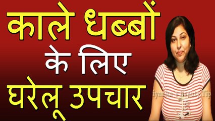 काले धब्बों के लिए घरेलु उपचार | Home Remedies For Dark Patches By Priyanka