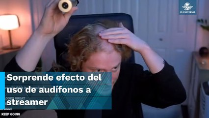 ¿Deformación del cráneo? Streamer muestra los efectos de usar audífonos todo el día