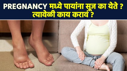 Pregnancy मध्ये पायांना सूज का येते ? | How to Reduce Swelling During Pregnancy | Lokmat Sakhi | RI3