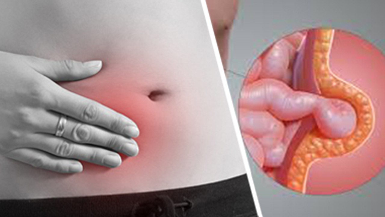 नाभि छूने में दर्द होना Hernia Symptom, Stomach Ulcer से लेकर Gallbladder Stone Reason | Boldsky