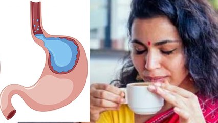 Tải video: 1 दिन में कितने कप नींबू चाय पीना चाहिए | 1 Din Me Kitne Cup Nimbu Chai Pina Chahiye | Boldsky