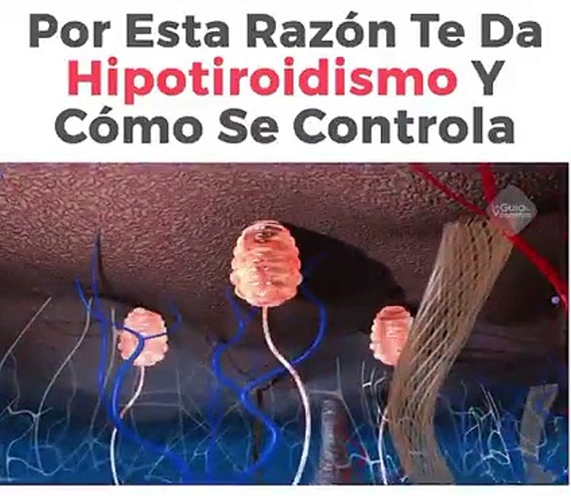 14. Por Esta Razon Te Da Hipotiroidismo y Como Se Controla