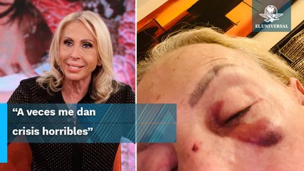 Laura Bozzo se confiesa al aparecer con golpes en su rostro: sufre depresión y ansiedad