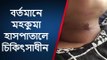 কোচবিহার: বউয়ের গলায় ওটা কিসের দাগ? শুনলে আঁৎকে উঠবেন