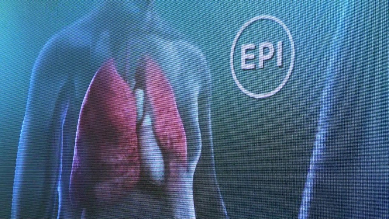 Expertos analizan el papel de las unidades multidisciplinares en la fibrosis pulmonar progresiva