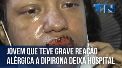 Jovem que teve grave reação alérgica a dipirona deixa hospital