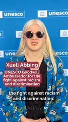 Kisah Xueli Abbing, Gadis Albino Yang Terbuang Namun Kini Model Berjaya!