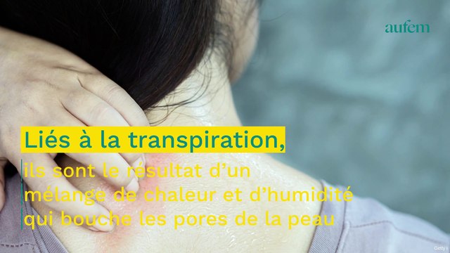 Boutons de chaleur : 3 gestes à éviter pour les faire partir plus vite