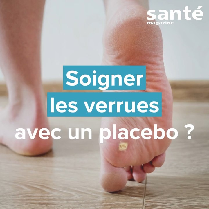 Soigner des verrues avec un placebo ?