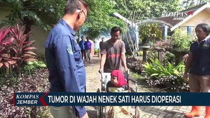 Nenek Miskin ODGJ di Jember Menderita Tumor di Wajah