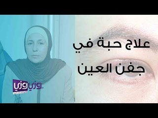 علاج حبة في جفن العين