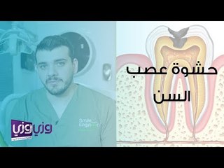 ما هي حشوة عصب السن؟