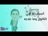 ما هي أسباب الثالول وما علاجه