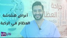 أعراض هشاشة العظام في الركبة