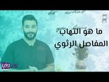 ما هو التهاب المفاصل الرثوي