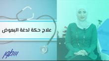علاج حكة لدغة البعوض