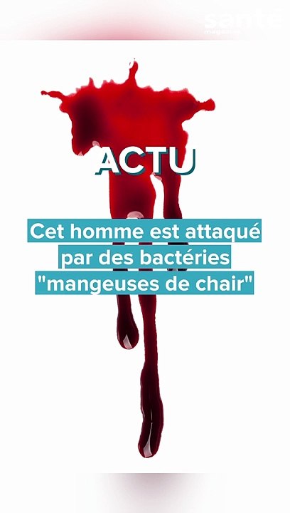 Un homme attaqué par des bactéries mangeuses de...