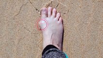 Bunion Correctors with Gel Pads - Help with Hallux Valgus Pain, Soreness, and Other Discomforts