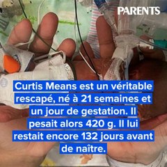 Né à 21 semaines : le nouveau record du monde du bébé prématuré à avoir survécu