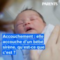 Accouchement : elle accouche d’un bébé sirène, qu’est-ce que c’est ?