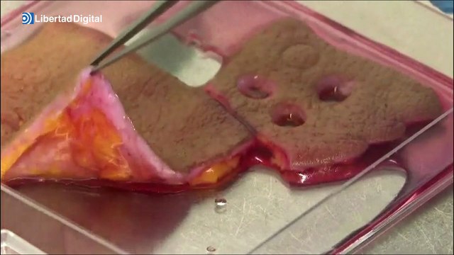 Desarrollan unos dispositivos de ADN que aceleran la cicatrización de las heridas