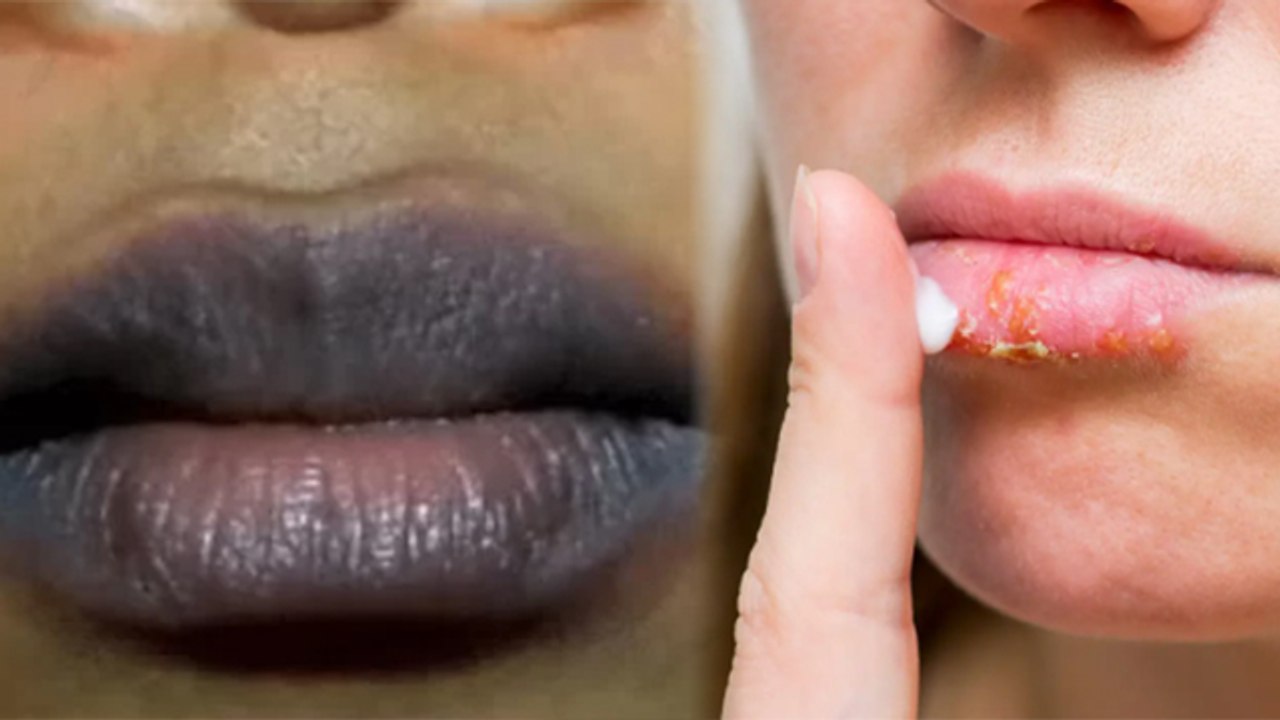 Lips पर Sunscreen लगाना चाहिए कि नहीं | होंठ पर सनस्क्रीन लगाना चाहिए कि नहीं | Boldsky