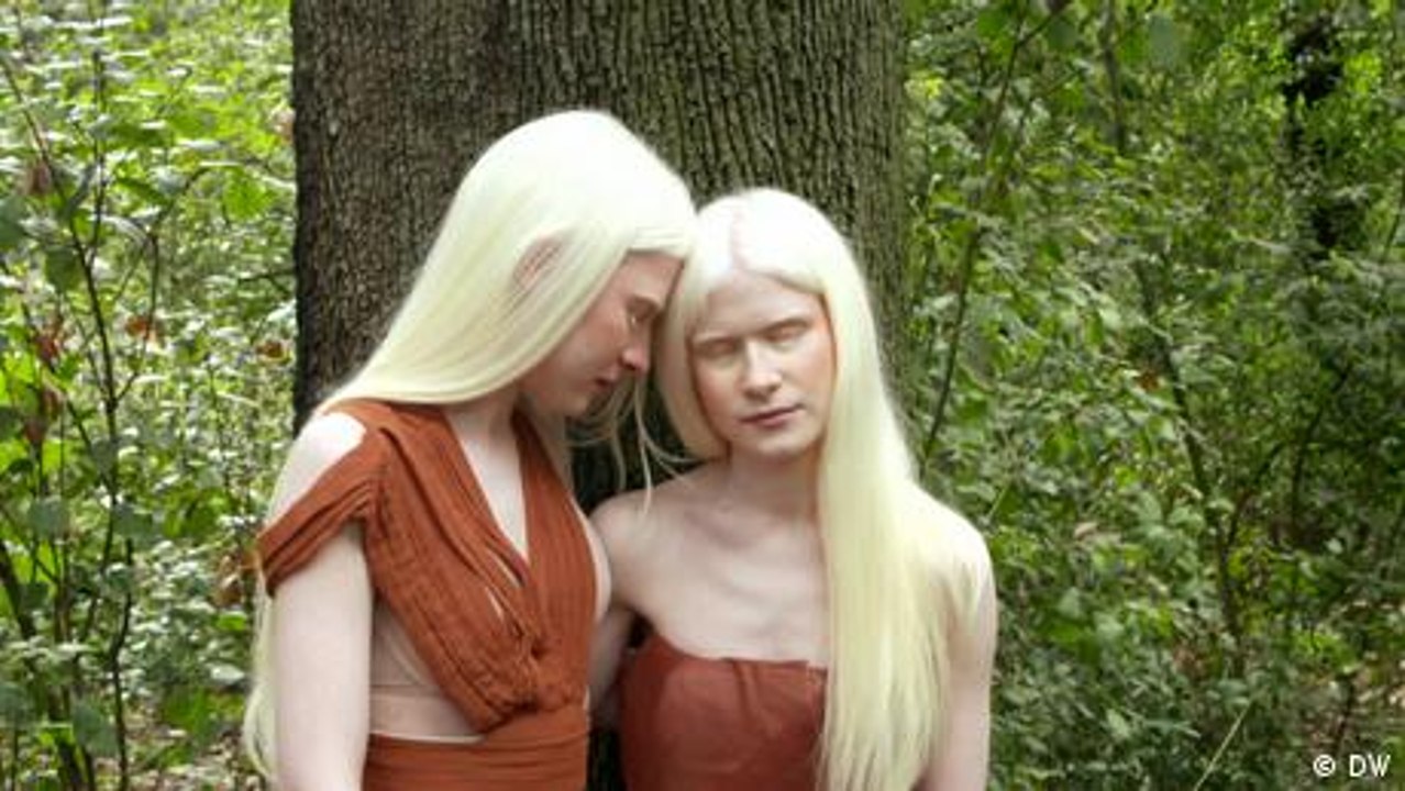 Ist Body Positivity schon wieder out?