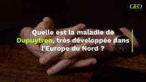 Quelle est la maladie de Dupuytren, très développée dans l'Europe du Nord ?