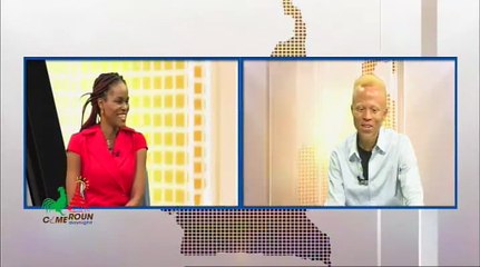 Concours MISS Albinos Le Master est sur le Plateau de CRTV News_130623