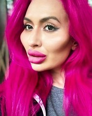 اغرب عمليات التجميل اللي عملتها الفنانات