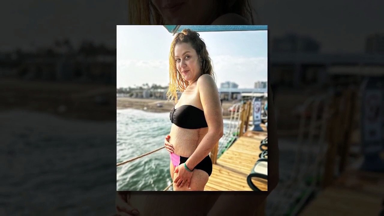 Aslı Samat, qui a perdu 108 kilos, a partagé sa pose en maillot de bain ! Tous ceux qui voient ton corps font le même commentaire