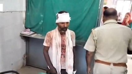 बलिया: जमीन के बटवारे को लेकर हुई जूतम पैजार, खुली खोपड़ियाँ तो चार पहुंचे अस्पताल