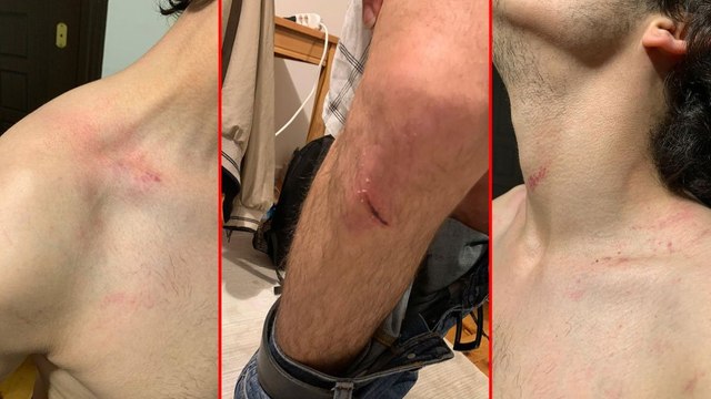 Süleyman Soylu ve korumaları hakkında suç duyurusu