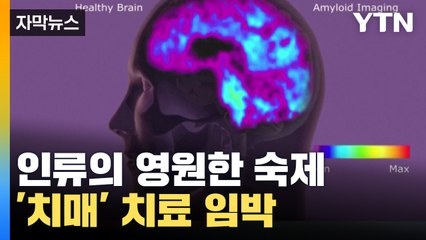 [자막뉴스] '슈퍼 신약' 곧 한국 상륙...치매 유력 물질 잡는다!  / YTN
