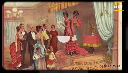 Conjoined Twins Born into Slavery Who Rose to Fame as Entertainers