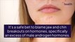Acne Face Mapping: How to Determine the Cause of Your Breakouts