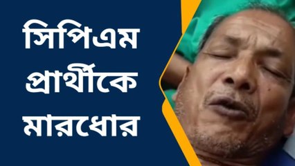 কোচবিহার: কাদায় মুখ চেপে ধরে... বৃদ্ধর পিঠে দগদগে আঘাত, শুনুন হাড়হিম অত্যাচার